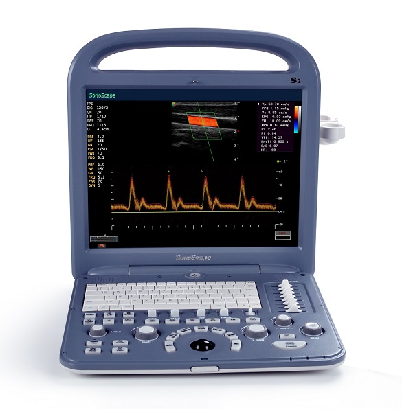 Echographe Doppler Couleur Portable d'Occasion SonoScape S2