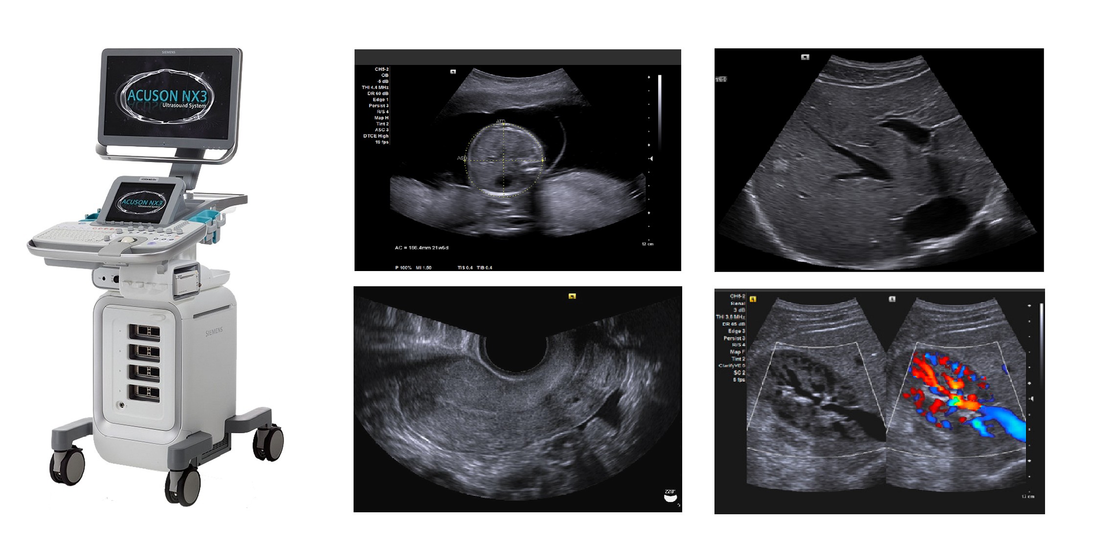 Echographe Doppler Couleur Siemens ACUSON NX3