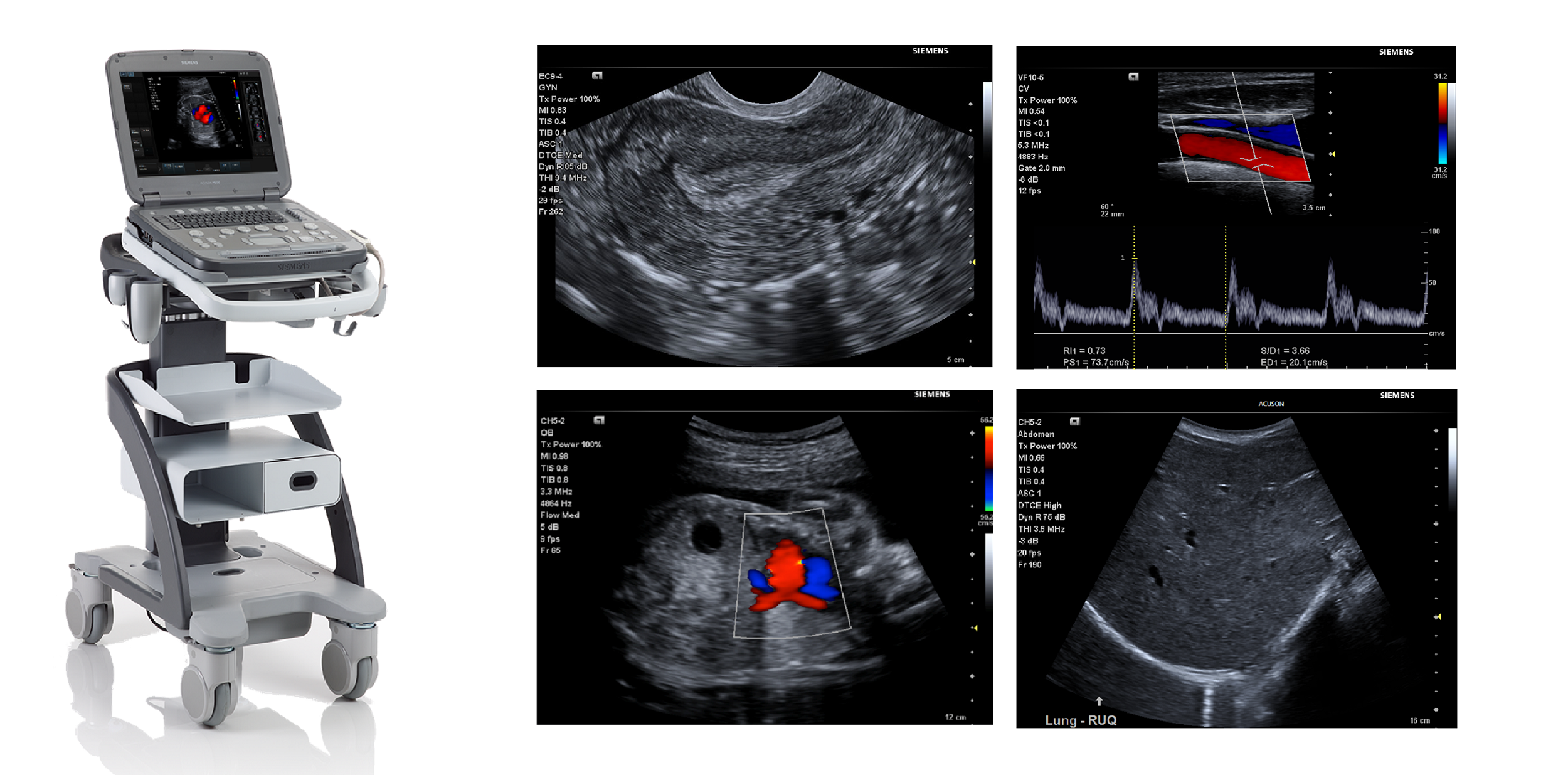 Echographe Portable Doppler Couleur Sur Chariot P500 