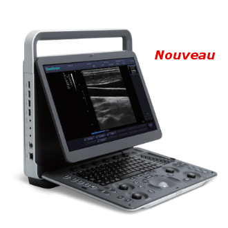 Echographe Portable Pour Urologue Noir et Blanc SonoScape E1 