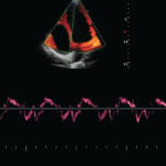 Appareil d'Echographie Tactile Cardiologie Doppler Tissulaire