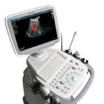 Echographe Couleur Doppler Gynécologie Obstétrique Abordable