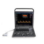 Echographe Portable Haut de Gamme Abordable Polyvalent SonoScape S8 Expert