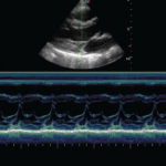 Echographe Portable Tactile Cardiologie