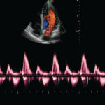 Echographe Portable Tactile Doppler Couleur pour la Cardiologie