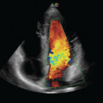 Echographe Portable Tactile Pour Doppler Cardiaque