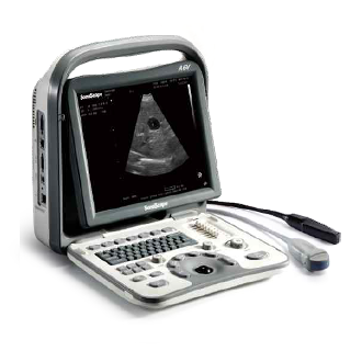 Echographe Portable Veterinaire Abordable SonScape A6