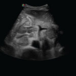 Echographe Tactile Radiologie