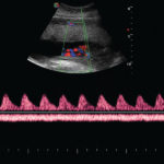 Echographe Tactile pour gynécologues